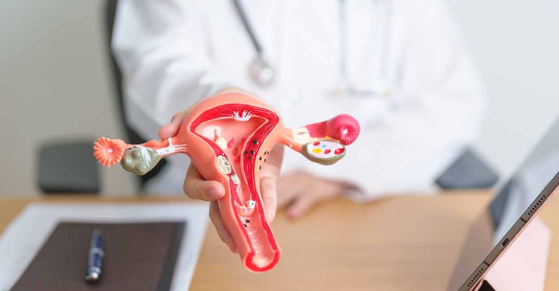 PMOS is a complex, long-term hormonal and metabolic disorder. Photo: Shutterstock/Jo Panuwat D