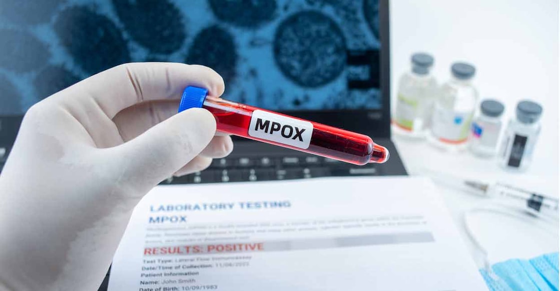 Droplets that become airborne when an infected person sneezes or coughs may carry the virus. Photo: iStock