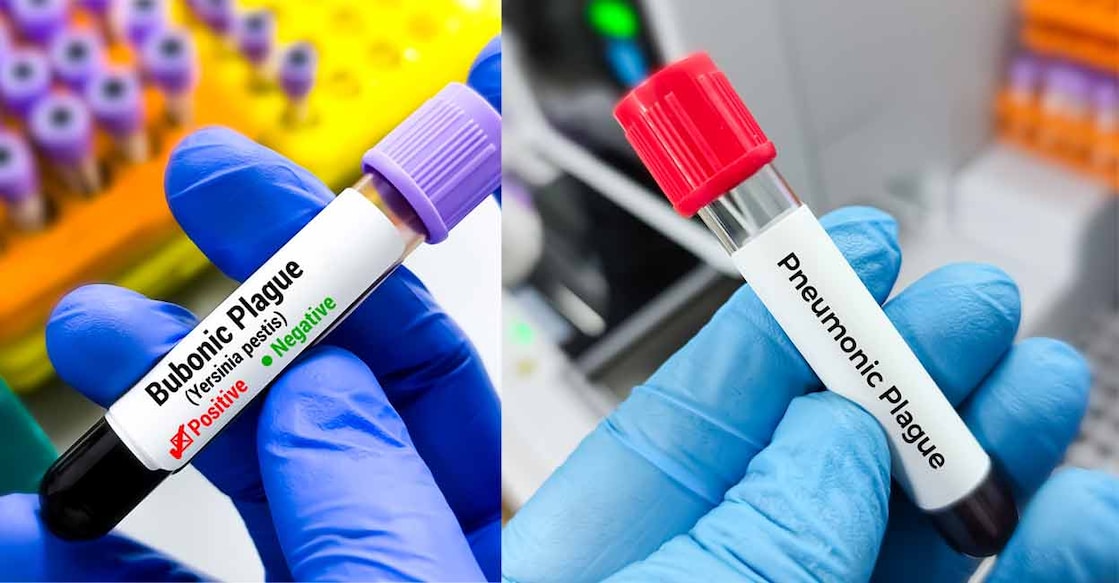 Plague is caused by the bacterium named Yersinia pestis, says the Cleveland Clinic. Photo: iStock/Md Babul Hosen/Md Saiful Islam Khan