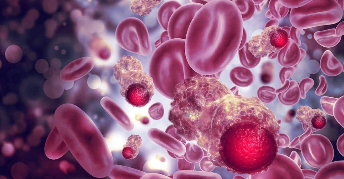 If a family member has a history of certain cancers, those genetic factors may be transmitted to subsequent generations. Photo: iStock/Mohammed Haneefa Nizamudeen