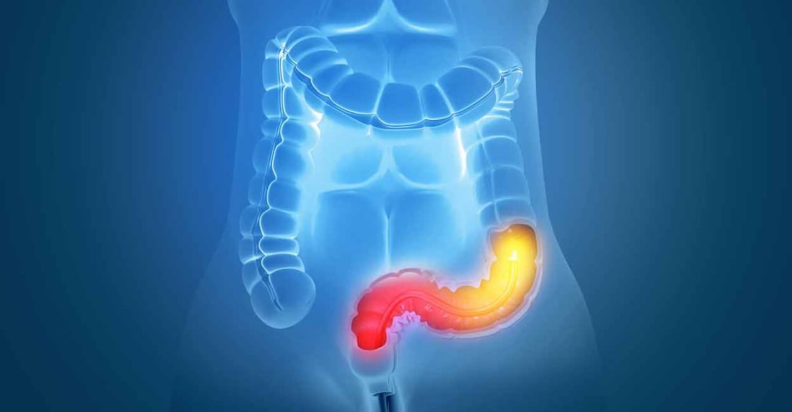 Traces of blood are found in stool as the virus affects the intestines. Photo: iStock/Mohammed Haneefa Nizamudeen