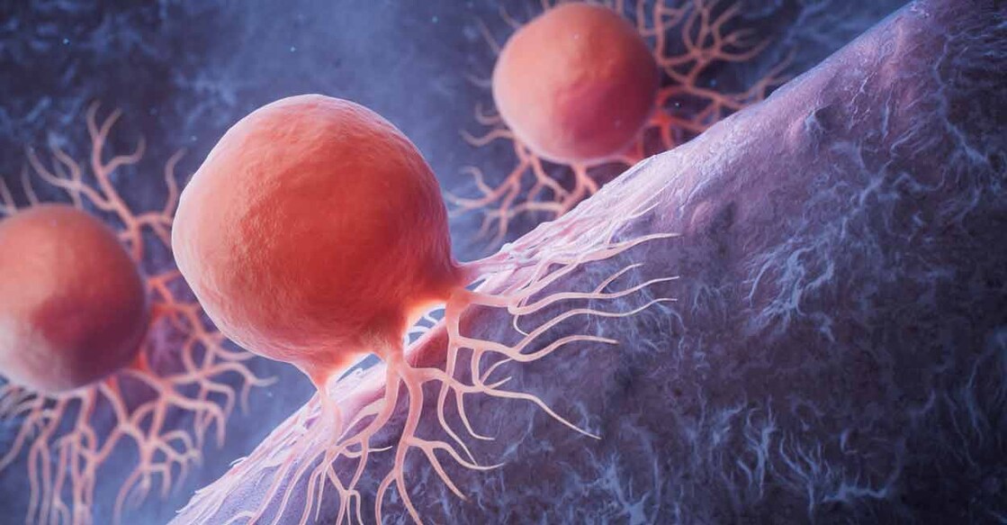 The emotional impact of multiple cancers can cause considerable strain on a patient. Photo: Shutterstock/Vink Fan