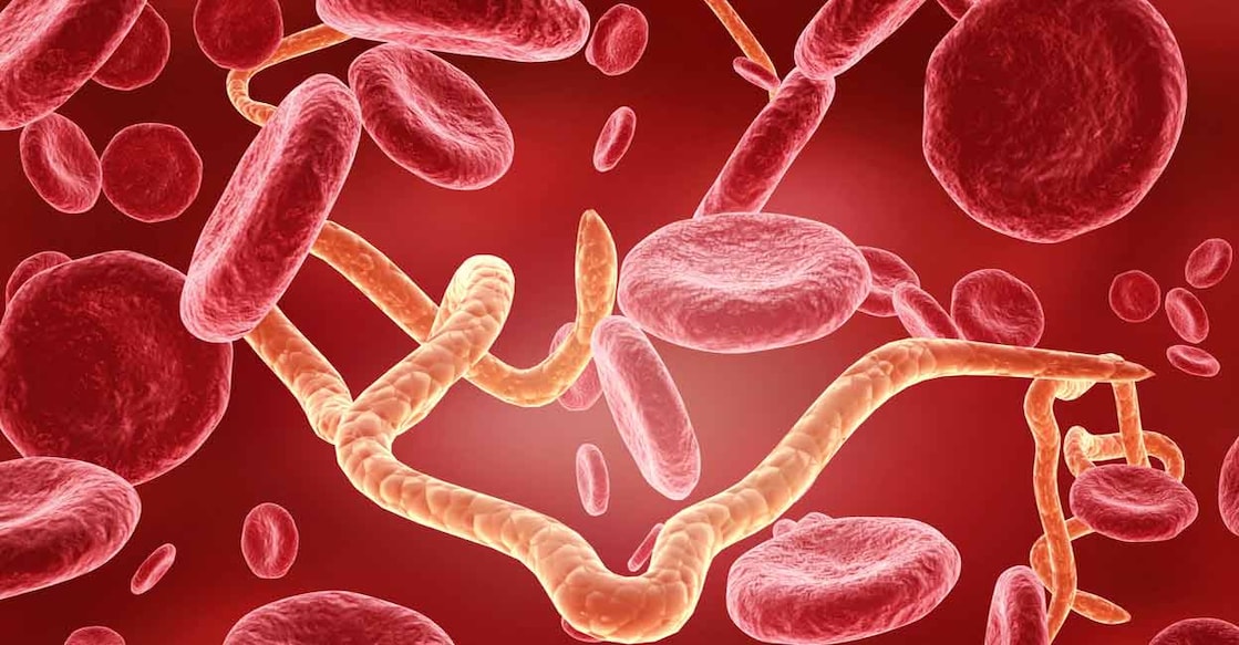 There is no treatment for the Ebola virus. Photo: iStock/Rasi Bhadramani
