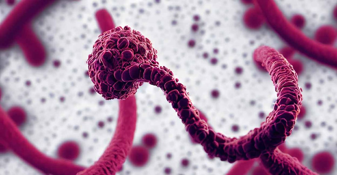India's Directorate General of Health Services (DGHS) has also issued a health advisory today for Ebola-affected countries. Photo: Shutterstock/apprenticebk