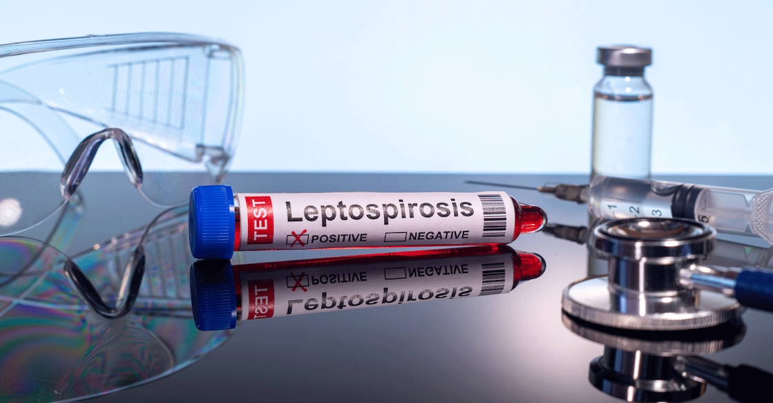 leptospirosis-rat-fever1