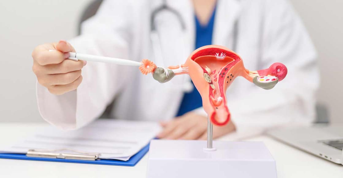 PMOS refers to Polyendocrine Metabolic Ovarian Syndrome. Photo: iStock/Panuwat Dangsungnoen