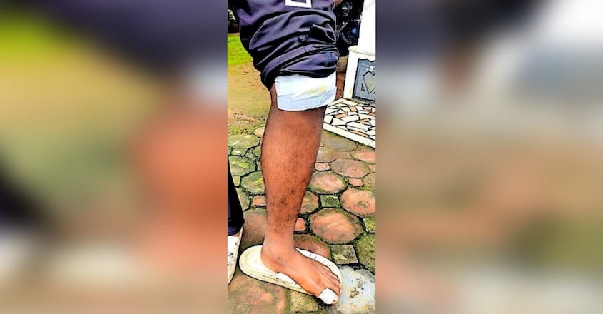 wild-elephant-attack-injury wild-elephant-attack-injury
