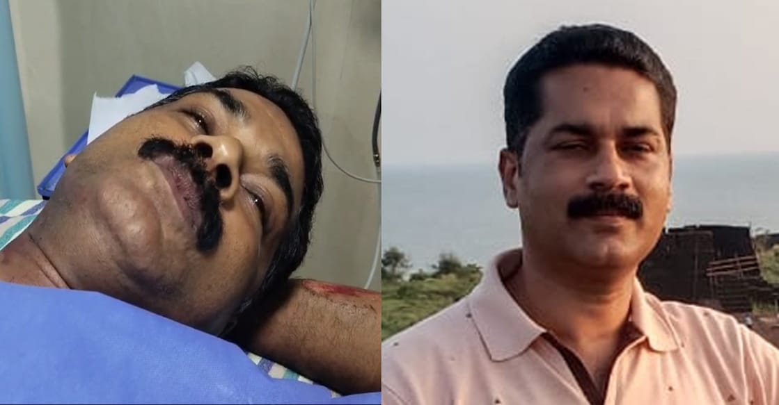 muvattupuzha-si-car-run-over Sub Inspector E M Muhammed has been admitted to Thodupuzha hospital after he was run over by a car during a vehicle check in Idukki. Photo: Special arrangement.