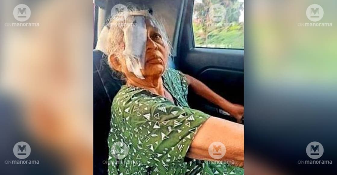 T P Omana, injured after being pecked by a bird in Kumarakom. Photo: Manorama.