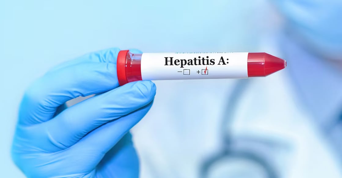 Representational image. Photo: iStock/SyhinStas