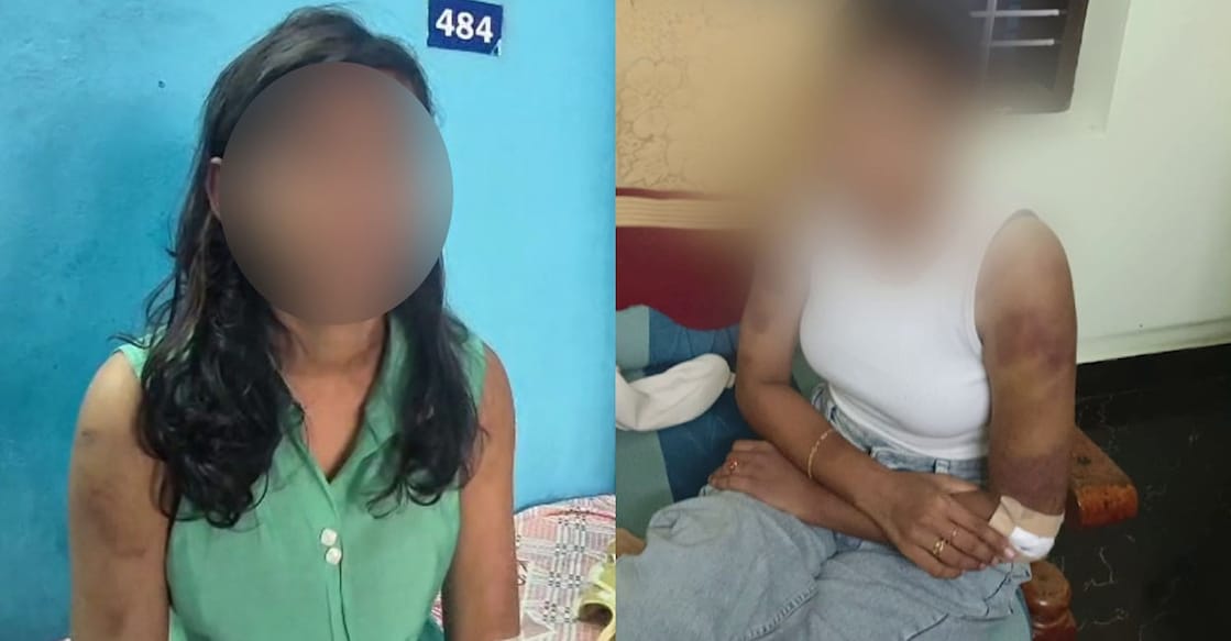 കൊല്ലത്ത് സ്ത്രീധനത്തിന്റെ പേരിൽ ക്രൂരമായി ആക്രമിക്കപ്പെട്ട അഞ്ജു. (Videograb: Manorama News)