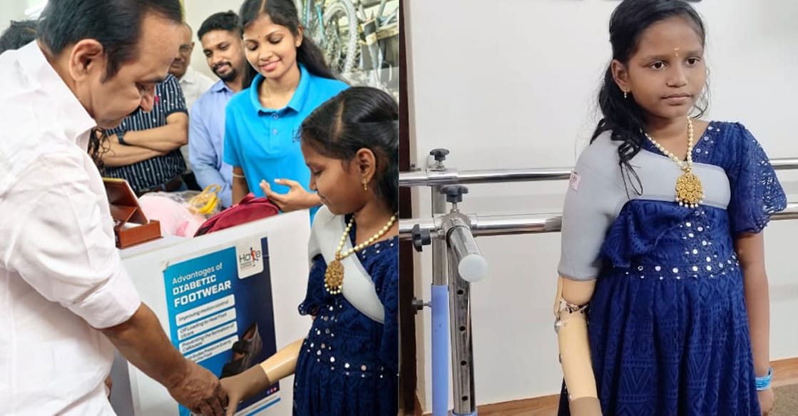 vinodhini-prosthetic-hand