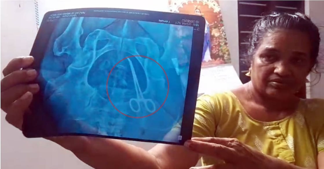 Usha (51) shows the X-ray of her abdomen which detected the scissors. Photo: Special Arrangement
