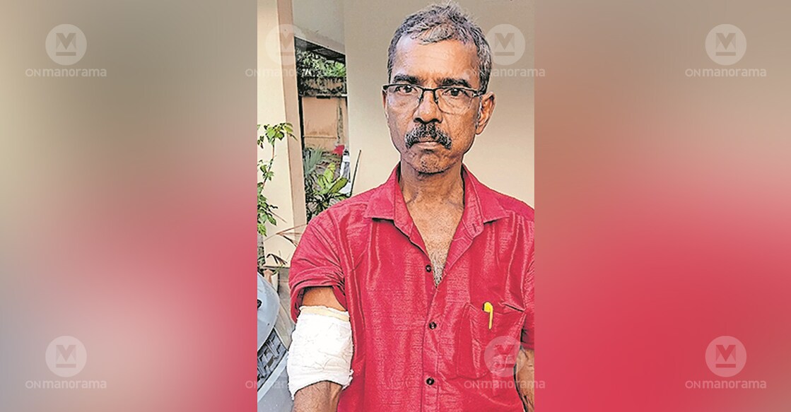 Radhakrishna Pillai showing the wound in his hand. Photo: Manorama