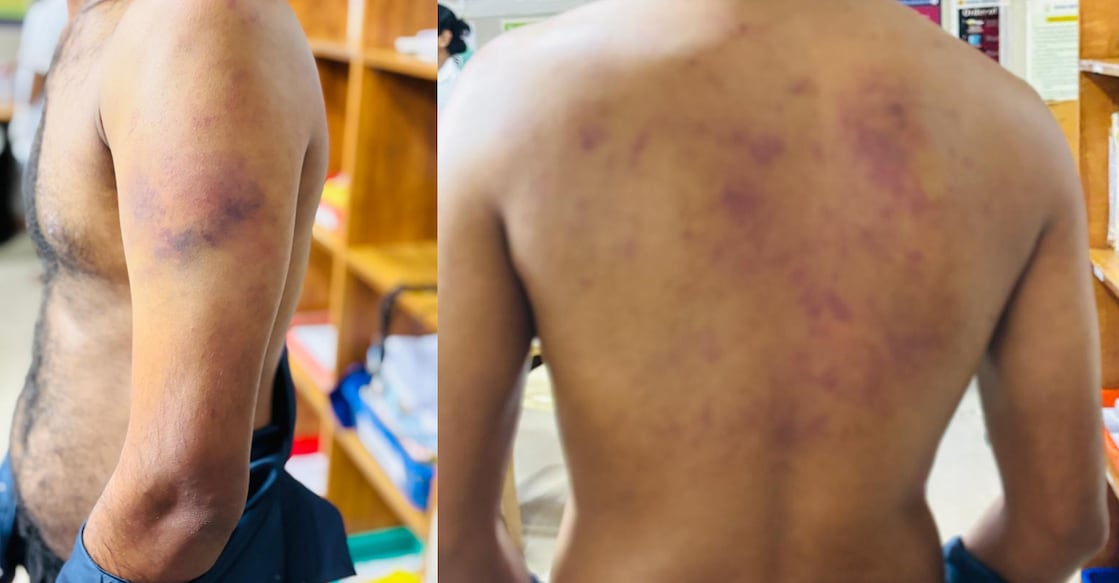 The injured youth. Photo: Special Arrangement