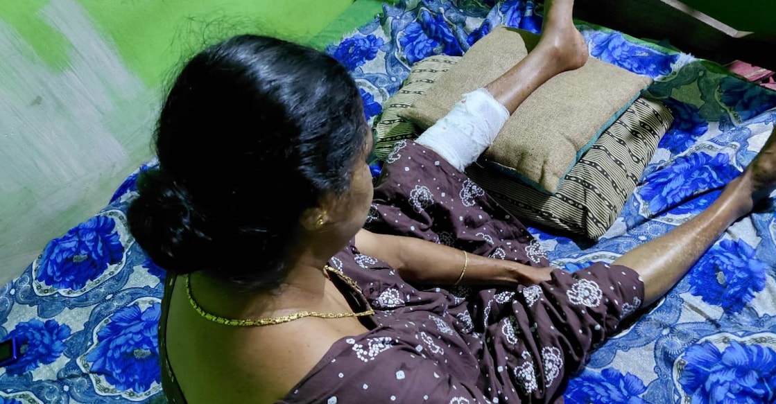 Saly Kurian and her fractured leg. Photo: Special Arrangement. 