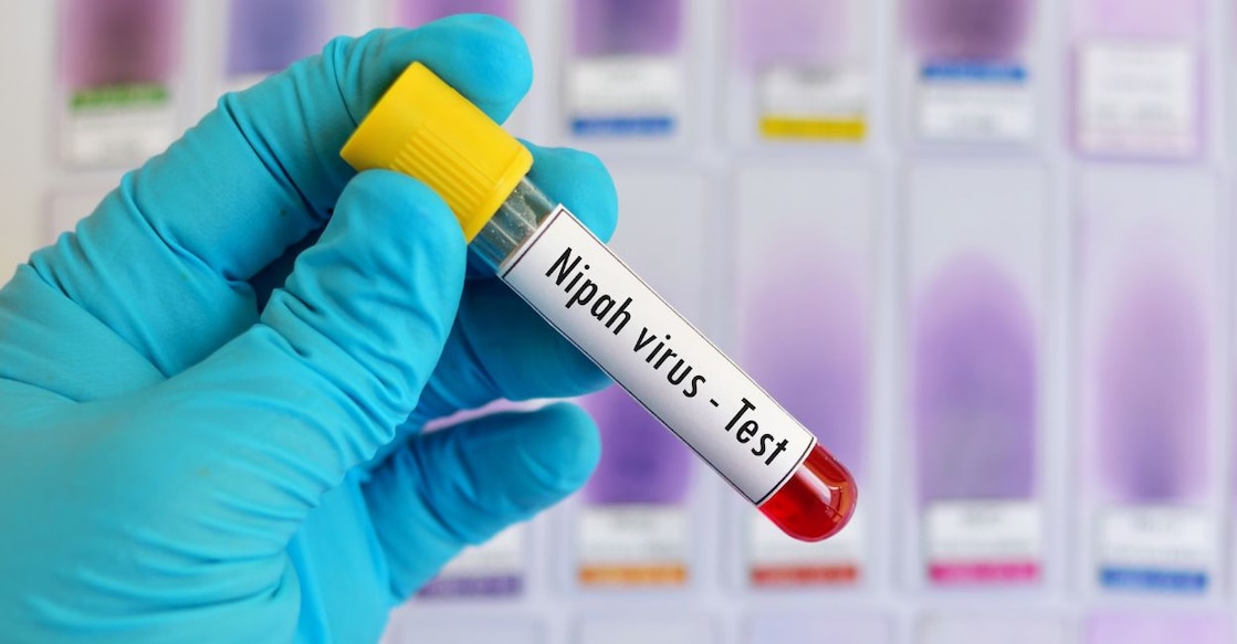 nipah-virus - 1