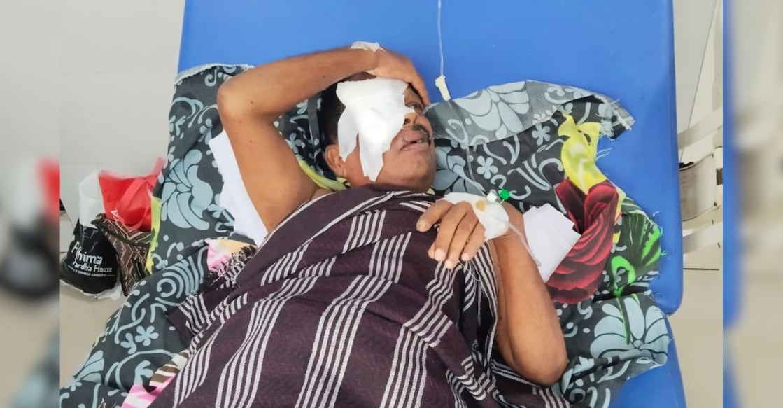 Chandran (61), hospitalised after he lost his eyelid in the stray dog attack. Photo: Special Arrangement