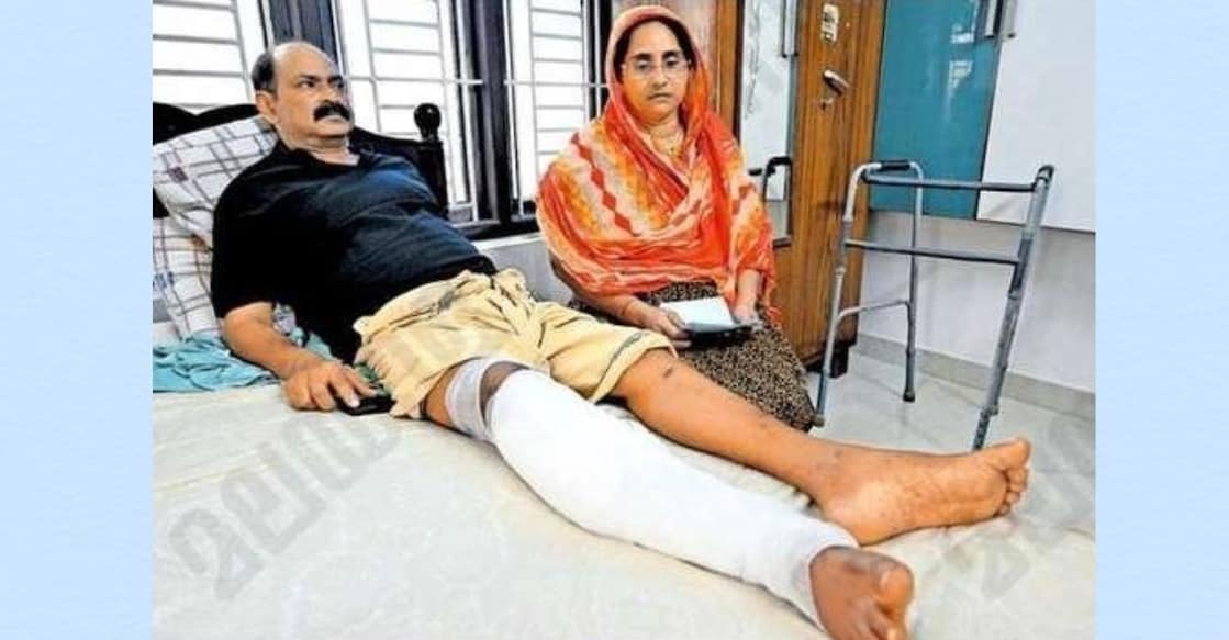 picture - muneer-stray-dog-bite