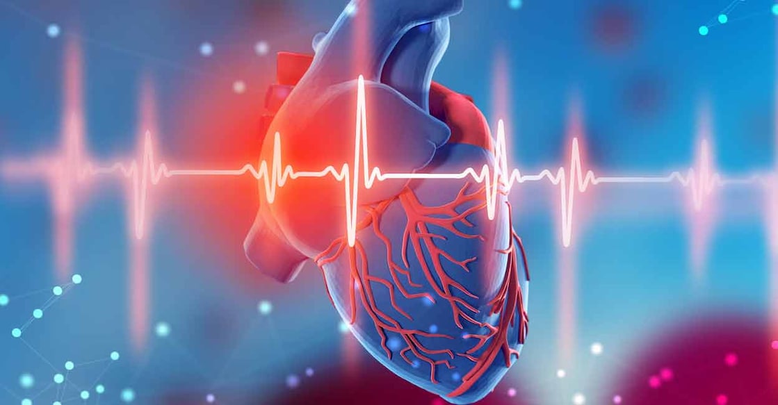 Most people who are rushed to the hospital with symptoms of cardiac arrest say that they couldn’t recognise the signs in advance. Photo: iStock/Rasi Bhadramani