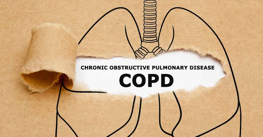 COPD  is commonly seen in people who have been smoking for many years and in those who work in environments with constant exposure to dust or smoke. Photo: iStock