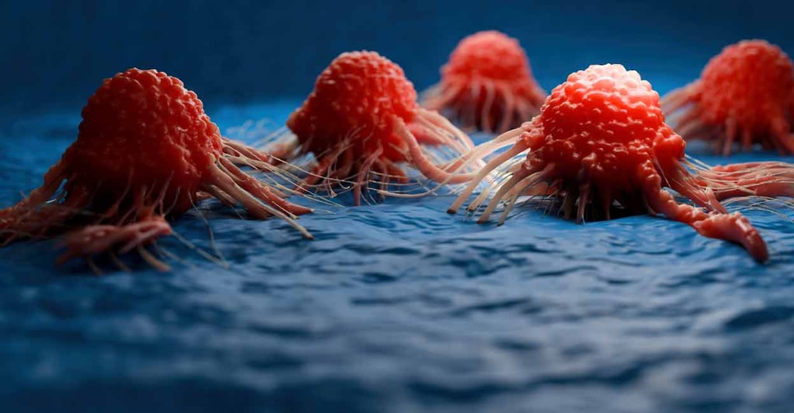 Those who have the BRCA1 and 2 genes are at risk of breast cancer. Photo: iStock