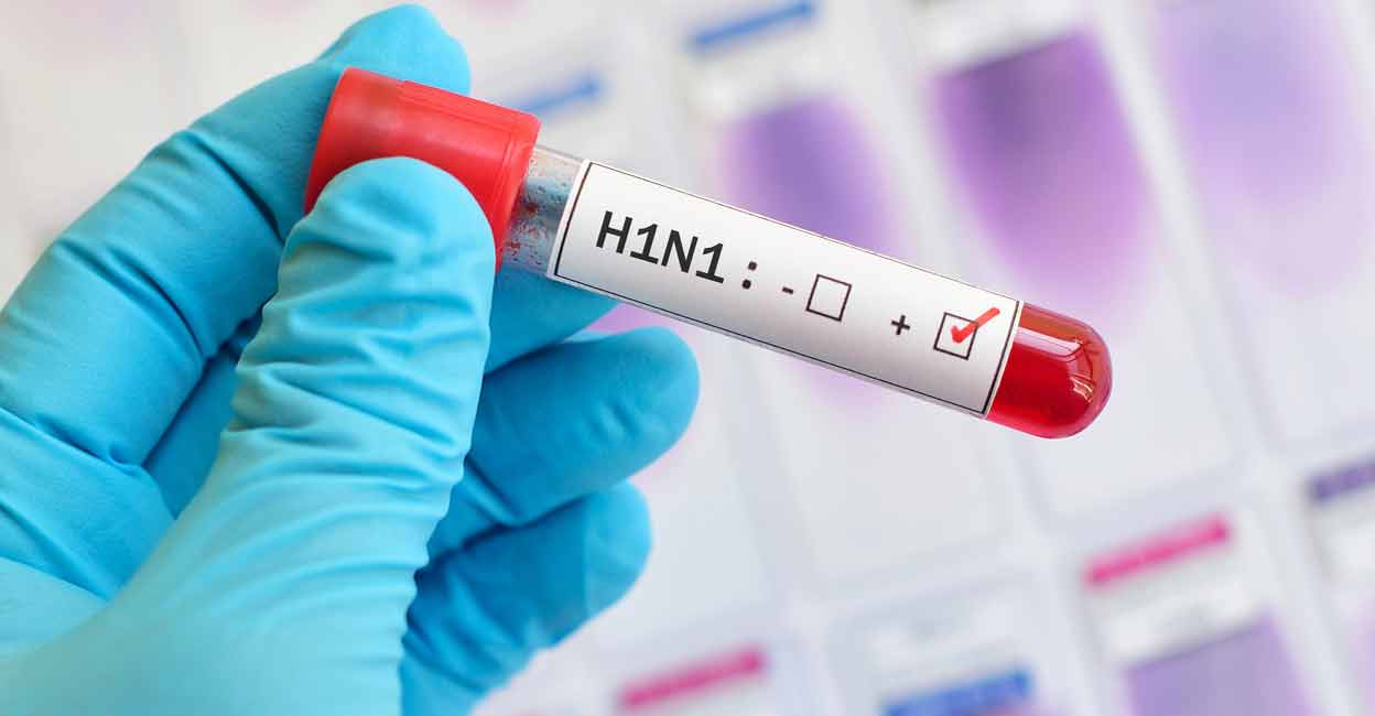 A 75-year-old woman has died, with health authorities investigating a suspected H1N1 infection pending official test confirmation..H1N1 infection Kochi, Swine Flu death Ernakulam, suspected H1N1 case, Lalithambika K death, Kochi health scare, respiratory illness outbreak, fever and breathing difficulties, private hospital incident, health department surveillance, airborne infection alert, PCR test confirmation, medical centre patient death, Edappally resident passes away, public health advisory, viral infection news