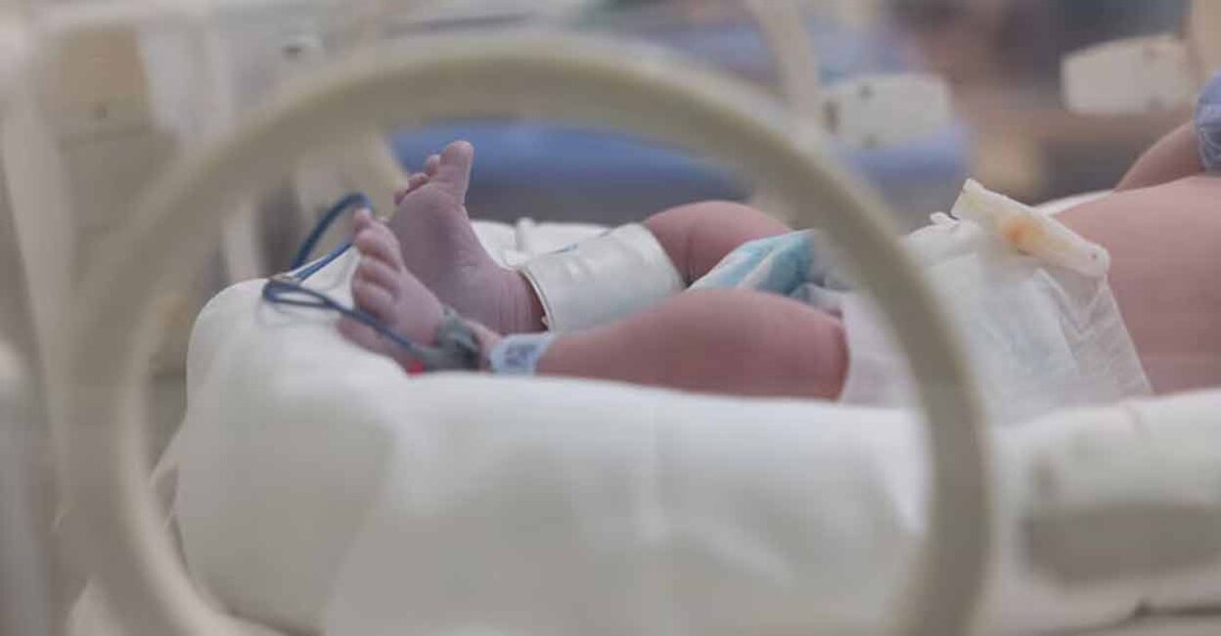 Detecting cyanosis with bare eyes is apparently challenging in milder cases, babies with darker complexion or babies with anaemia. Representative image/iStock/Ratchat