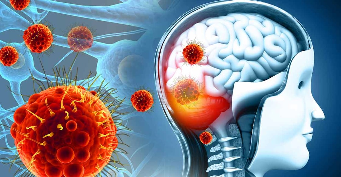 The boy, a student from Shooranad in Kollam, made the recovery through advanced treatment at the Thiruvananthapuram Government Medical College.  Photo: iStock/Mohammed Haneefa Nizamudeen