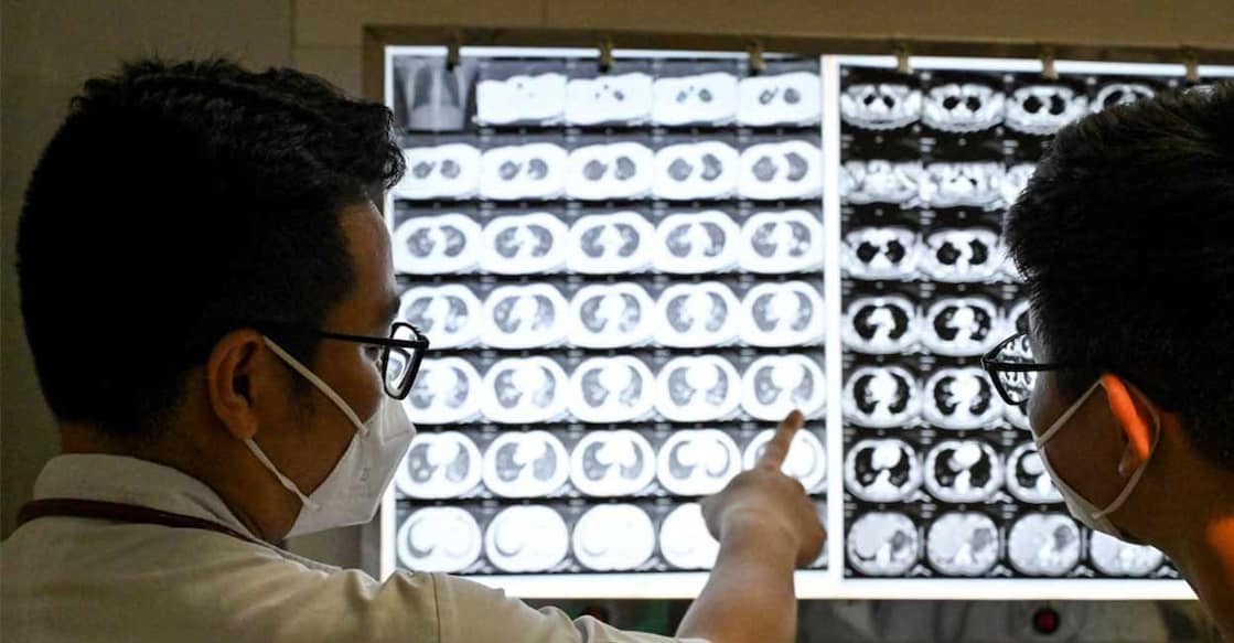 India accounted for the most number of TB cases in 2024, followed by Indonesia, the Philippines, China, and Pakistan. Photo: AFP