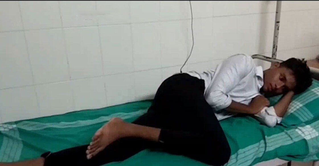 Ragging leaves student with ruptured eardrum
