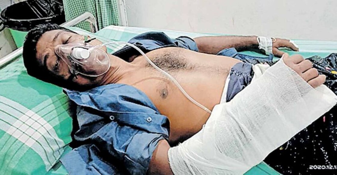 CPM worker hacked by goons at Erattupetta