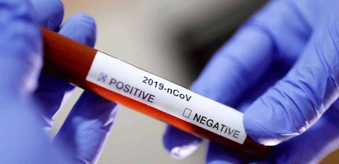 Affordable COVID-19 test method developed by IIT-Delhi gets ICMR nod