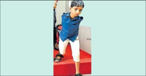 After fighting disability all life, little Asim is all set for a new battle