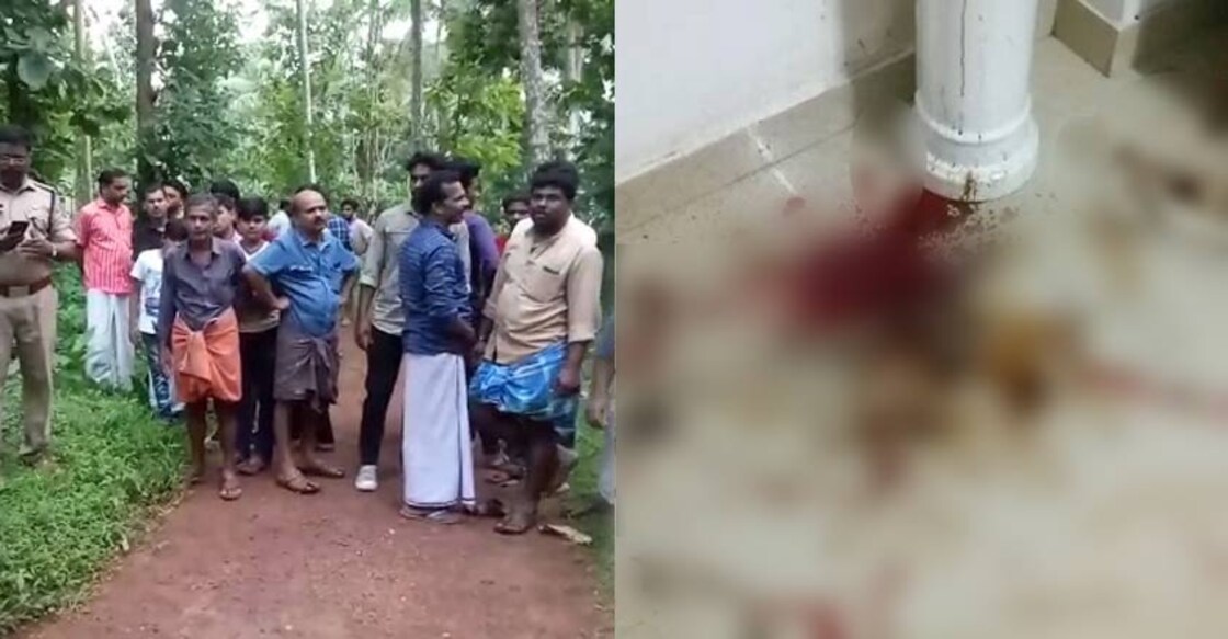 Kozhikode woman battles for life as estranged husband stabs her after flinging acid