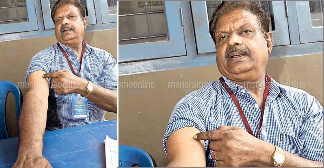 LTTE mine-blast survivor is here living a quiet life