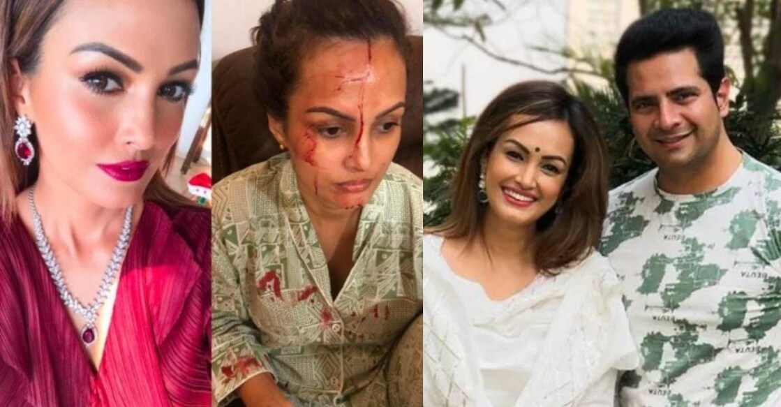 nisha-rawal-karan-mehra