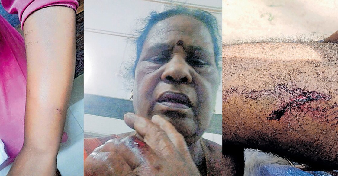 The actress was attacked while feeding the dogs near Bharathannoor market. Video image