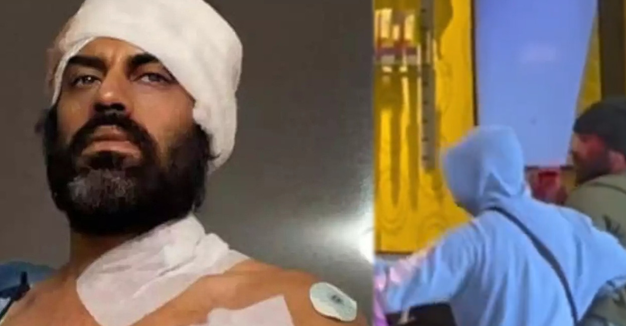 aman-dhaliwal Dhaliwal, who is currently hospitalised, has sustained injuries and scars on his torso. Photo: IANS | Twitter