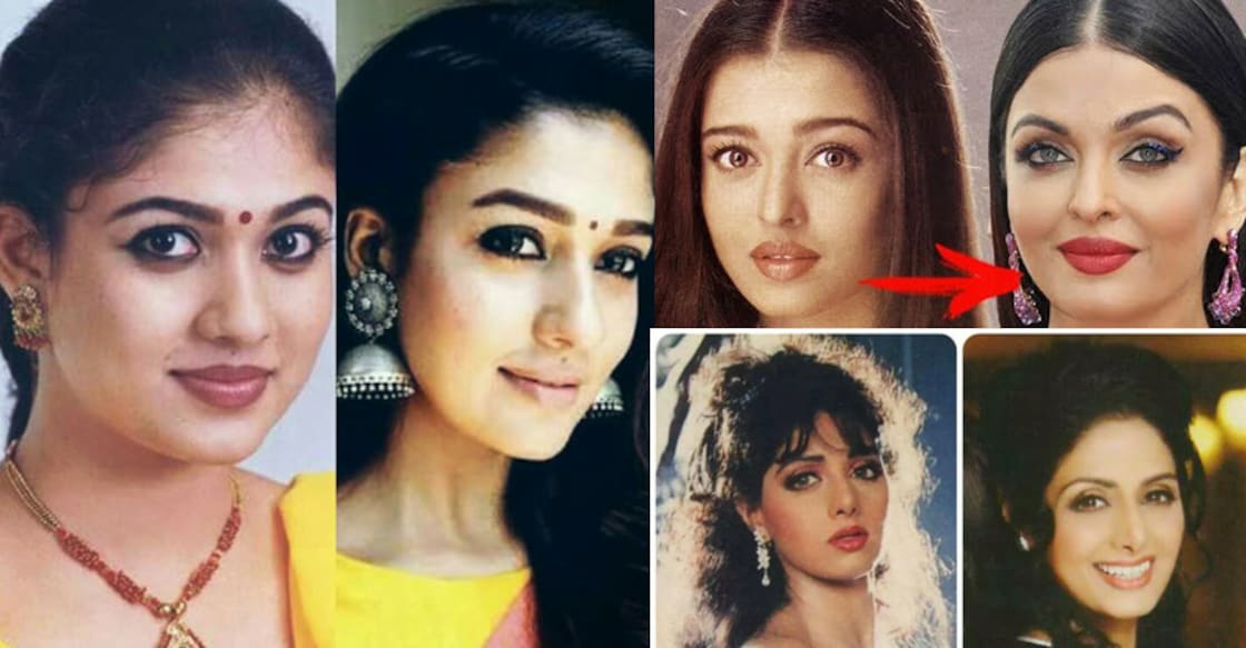actresses-plastic-surgery