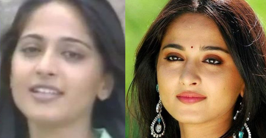 Check out how plastic surgery transformed these actresses