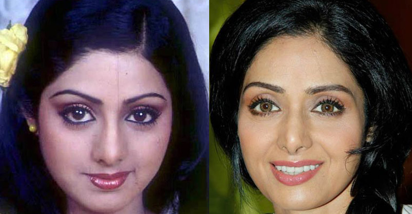 Check out how plastic surgery transformed these actresses