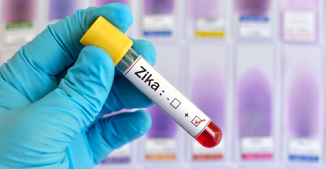 Zika virus test