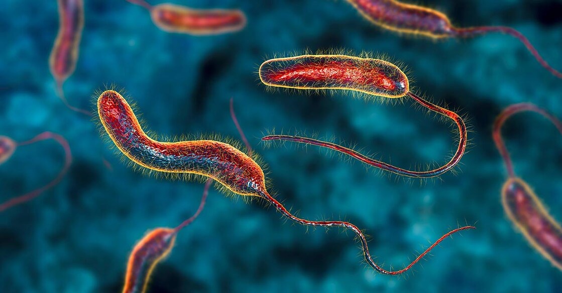 cholera3-ls Representational image: Shutterstock/Kateryna Kon