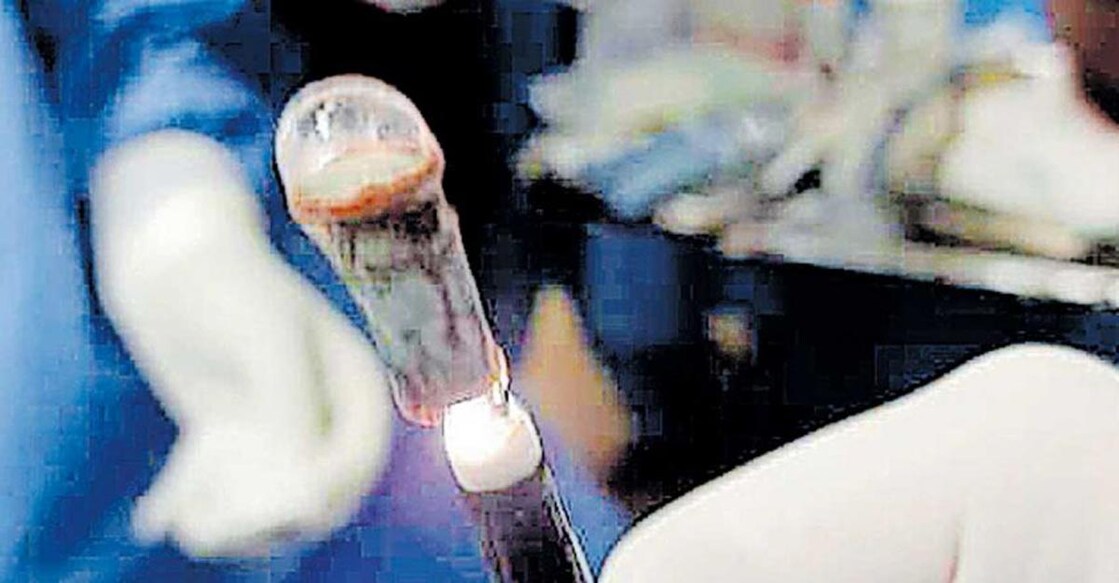 The plastic whistle retrieved from a 40-year-old woman's windpipe