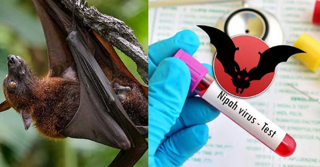 Nipah virus