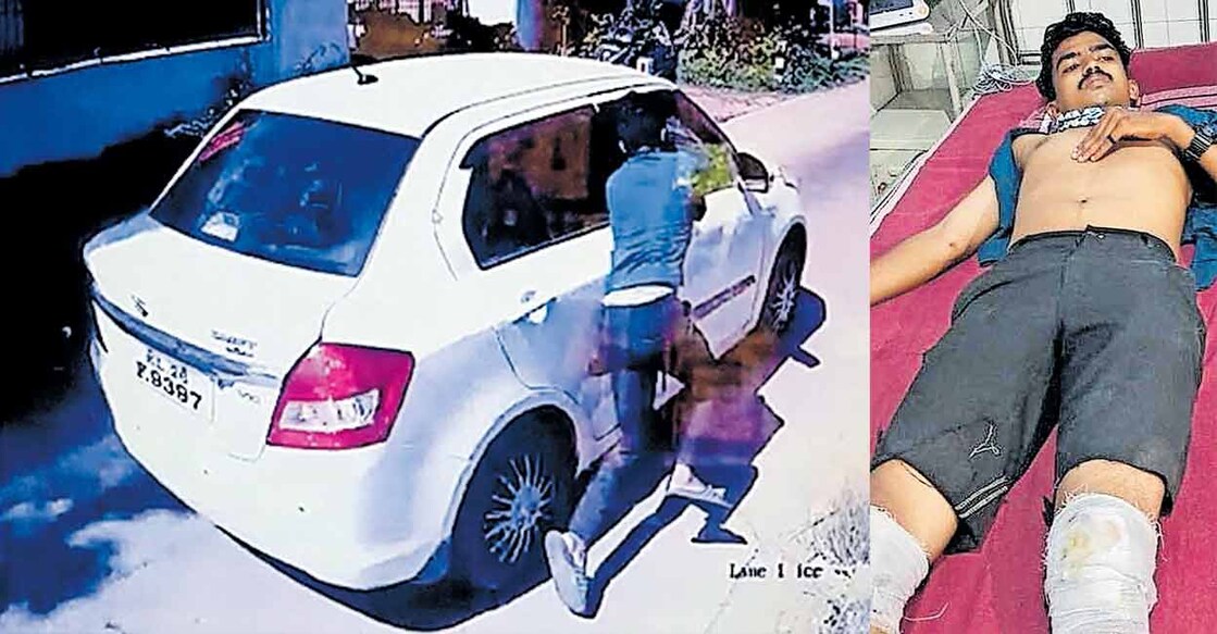 arun-toll-plaza The injured man, Kureeppuzha Plavarakkavu Theril Thekkethil Arun, aged 23, a contract staff with Kureeppuzha toll plaza on Kollam Bypass road, has been admitted to a private hospital