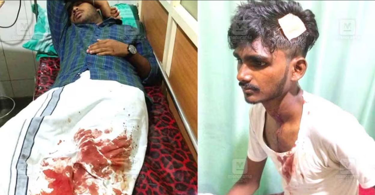 Youth Congress members were admitted to a hospital in Taliparamba after they were assaulted by volunteers of Nava Kerala Sadas for waving black flags at the special bus. Photo: Manorama Online