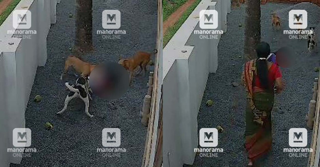 CCTV visuals of the stray dogs attacking Jhanvi (9). 