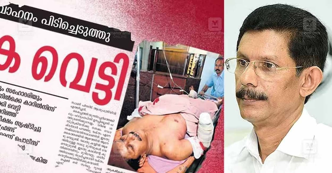 professor-tj-joseph-hand-chopping The case pertains to the brutal attack on Malayalam professor T J Joseph by Islamic fundamentalists. Photo: Manorama